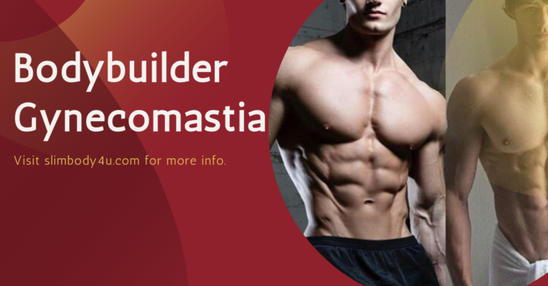 Bodybuilder Gynecomastia